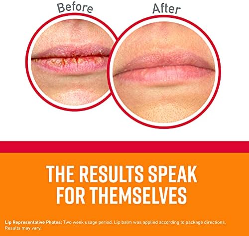 או ' קיף של תרופות השפה תיקון החותם & לרפא את שפתיים Protectant, מקל (חבילה של 2)